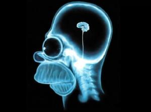 X-Ray Cihazında Beyin Pörtlemesi